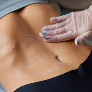 Dermatofuncional